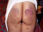 bottom spank wife